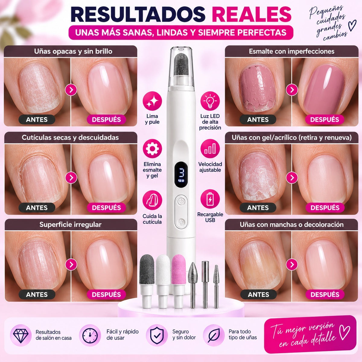 Resultados del Lumi Nail Pro: antes y después en uñas opacas, estriadas y con gel